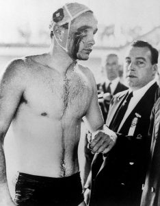 Zádor, Hungarian water polo player, bloodied by USSR in 1956 Olympics.