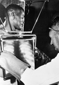 Mine worker x-rayed for diamond check, South Africa, 1954.