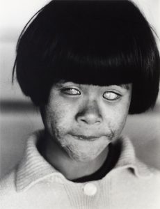 Blind girl captured by Christer Strömholm, nuclear blast aftermath, 1963.